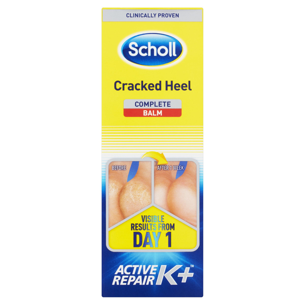 Scholl Krém na rozpraskané paty s Keratinem 60 ml Scholl